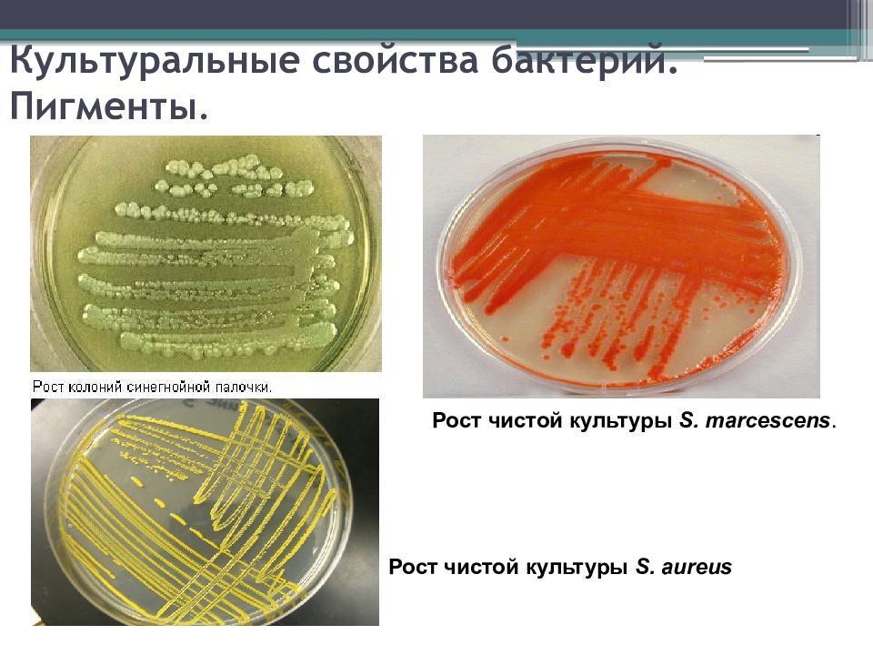 Свойства микроорганизмов. Культуральные свойства бактерий пигменты бактерий. Культуральные свойства чистая культура. Микроорганизмы культуральные свойства микробов. Культуральные свойства микроорганизмов.