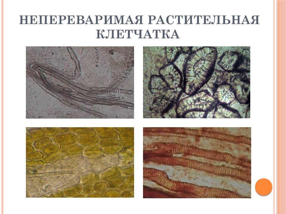 Растительная клетчатка в кале. Микроскопия кал непереваримая клетчатка. Непереваримая клетчатка в Кале. Микроскопия кала растительная клетчатка. Микроскопия кала переваримая клетчатка.