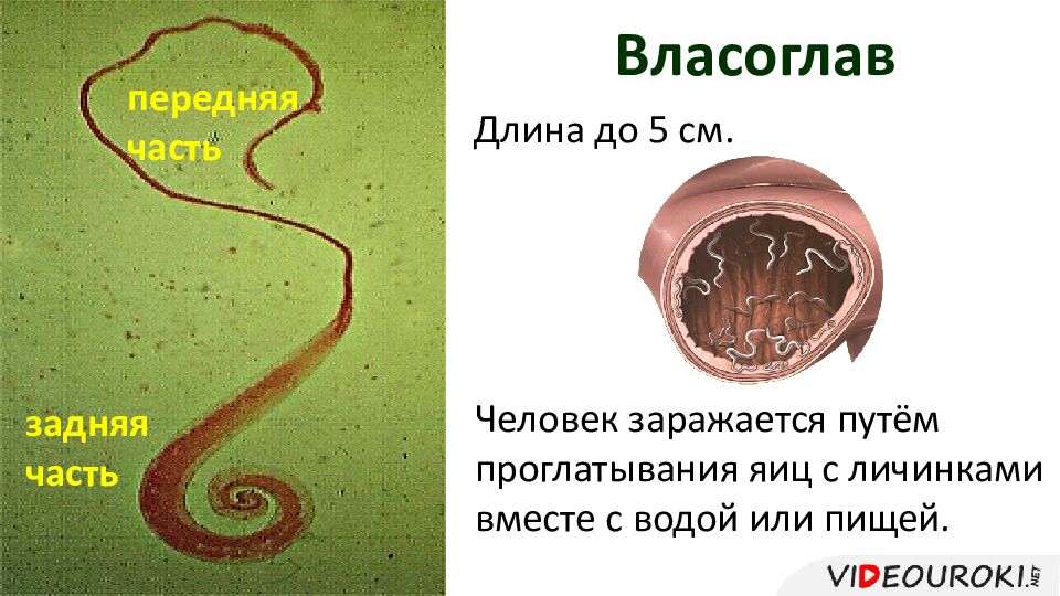 Власоглав