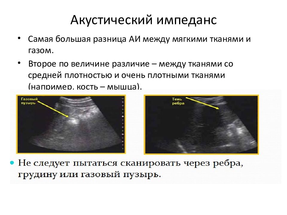 Ультразвуковая диагностика презентация