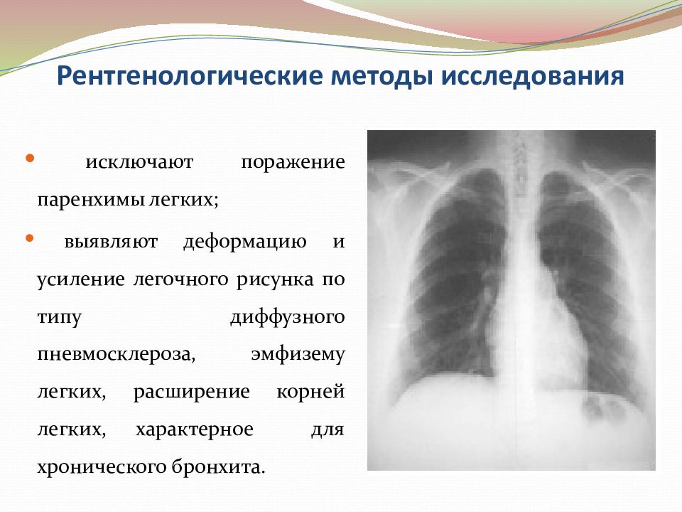 Легочный рисунок несколько деформирован по пневмосклеротическому типу