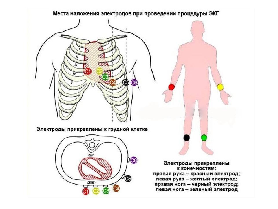 Структурная схема экг