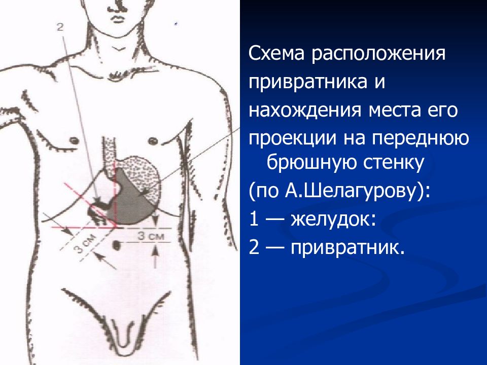 4 нарисовать топографическое расположение отделов толстого кишечника при глубокой пальпации живота