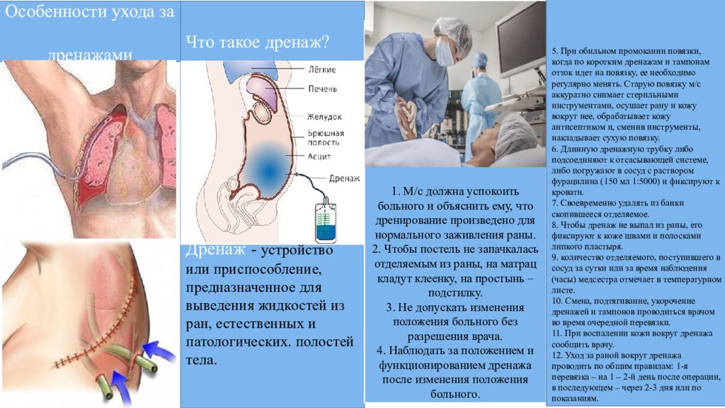 Дай ран. Особенности ухода за дренажами. Особенности ухода за больными с дренажами. Осуществление ухода за дренажом. Уход за дренажами алгоритм.