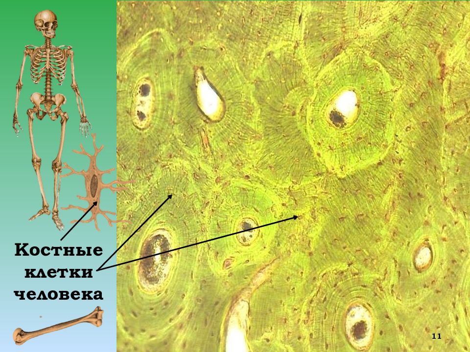 Световой микроскоп клетки. Костные клетки. Костная клетка человека. Костяная клетка. Костная ткань под микроскопом.