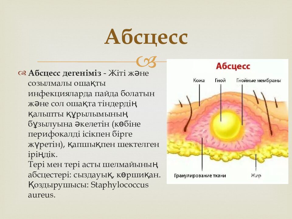 Абсцесс