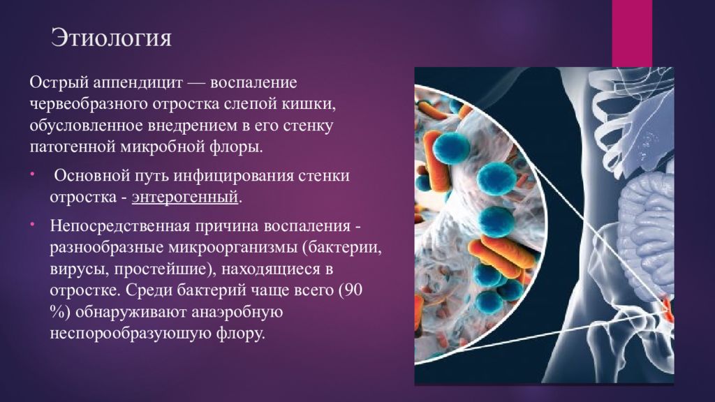 Осложнения острого аппендицита презентация