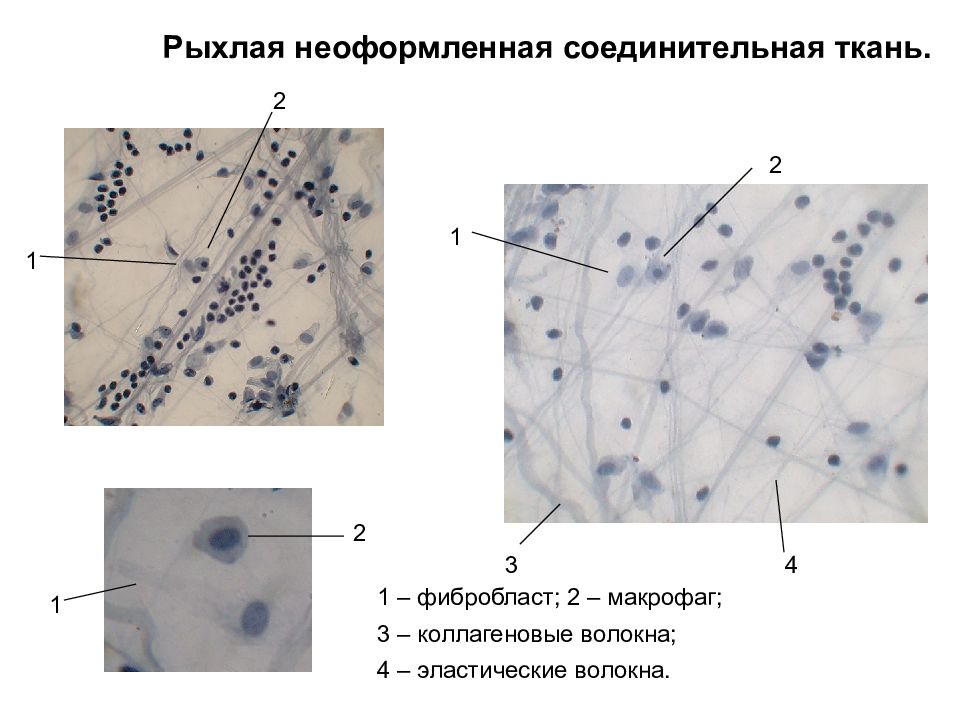 Рыхлая волокнистая неоформленная соединительная ткань рисунок