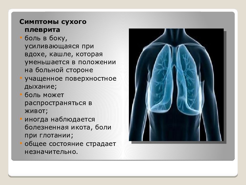 Сухой признак. Плеврит симптомы. Легочный звук.