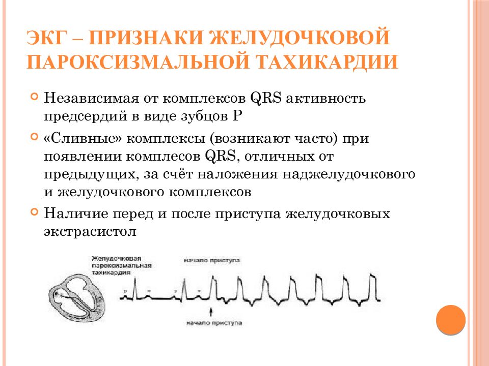 Наджелудочковая тахикардия презентация