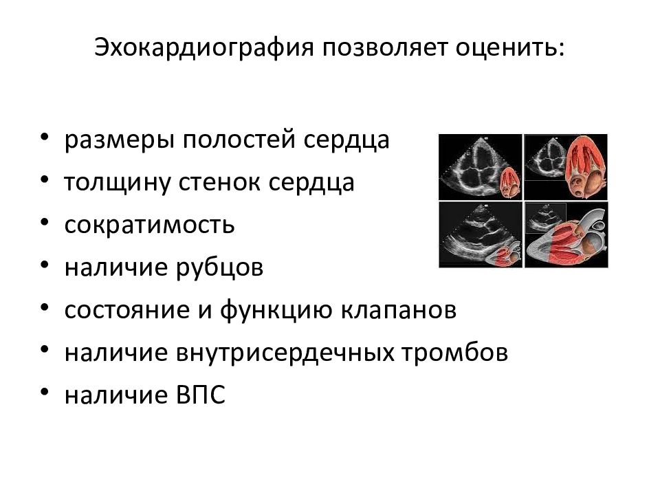 Математика в кардиологии презентация