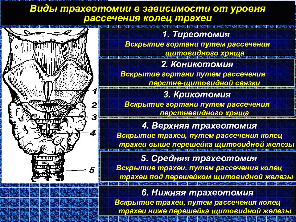 Трахеотомия. Трахеостомия топографическая анатомия. Верхняя и нижняя трахеостомия топографическая анатомия. Верхняя трахеостомия техника.