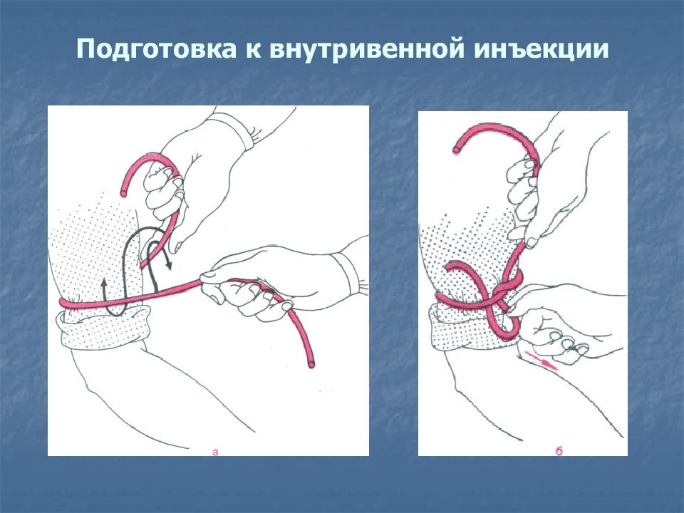 Внутривенно струйно алгоритм. Наложение жгута для внутривенной инъекции. Введение внутривенной инъекции. Внутривенные и внутримышечные инъекции. Техники внутривенного введения.