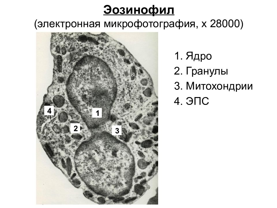 Ядро эозинофила. Эозинофильный гранулоцит Электронограмма. Эозинофильный гранулоцит микрофотография. Тромбоцит Электронограмма. Эозинофилы микроскопия.