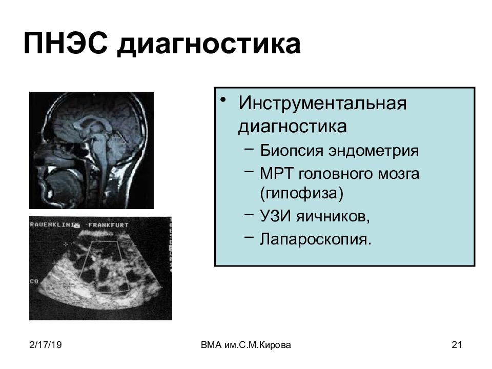 Нейроэндокринные синдромы в гинекологии презентация