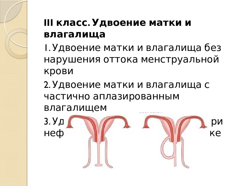 Аномалии женских половых органов презентация