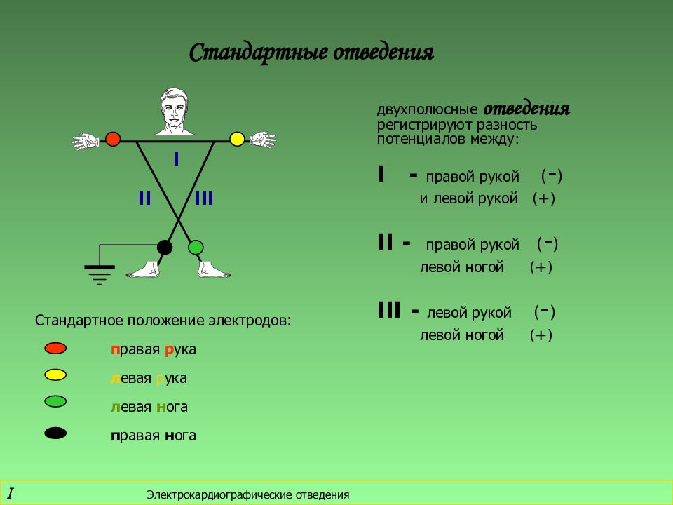 Экг отведения картинка