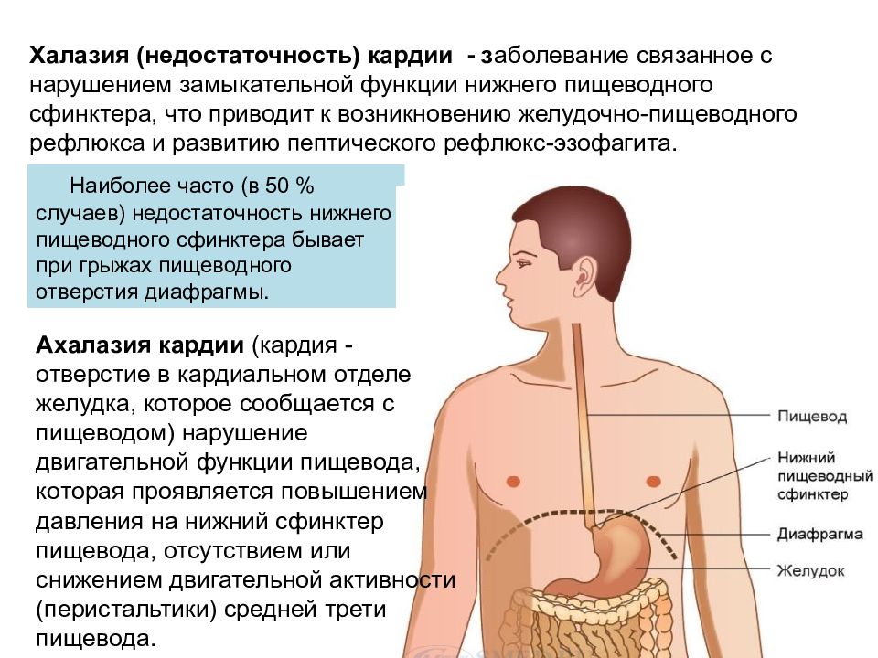 Чем лечить недостаточность кардии желудка препараты схема