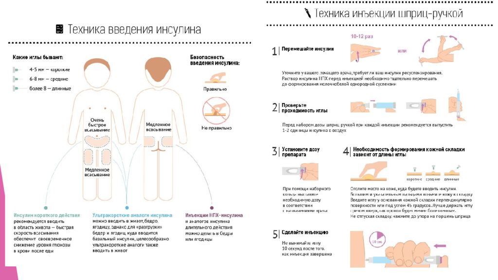 Картинка введение инсулина