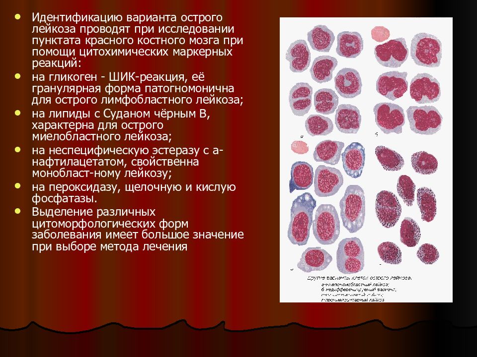 Острые лейкозы у детей презентация