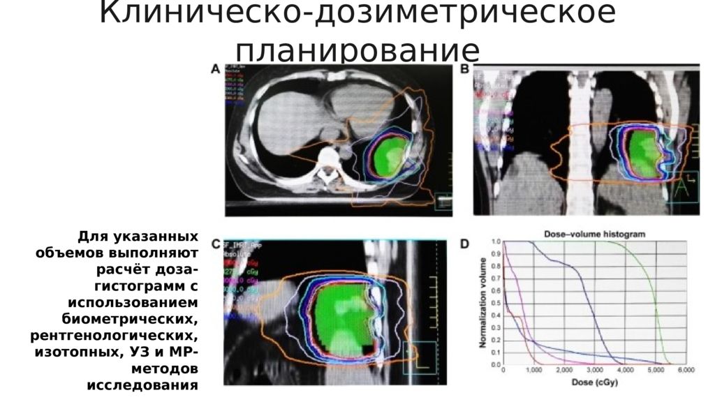 Планирование лучевой терапии презентация