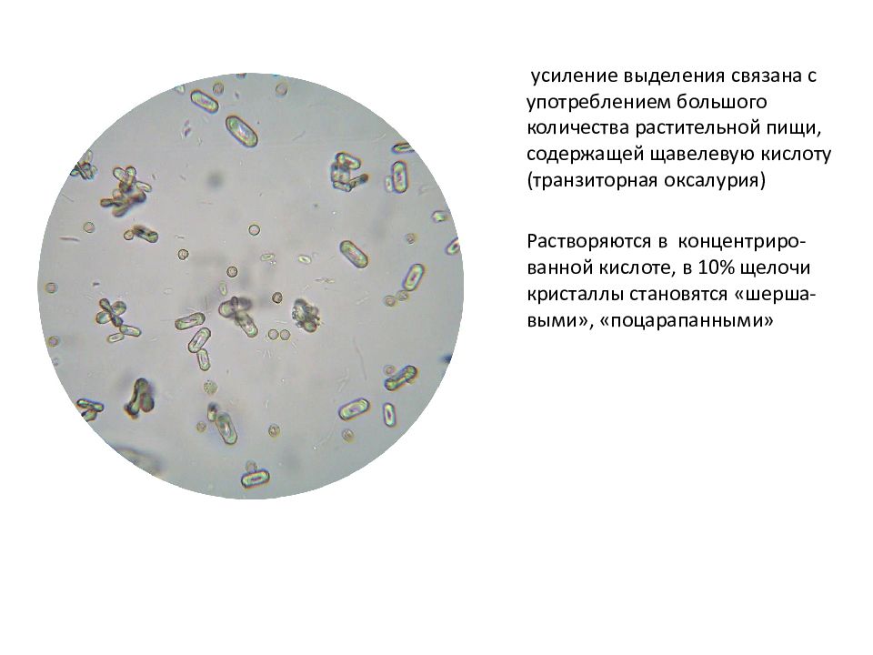 Микроскопия осадка мочи фото