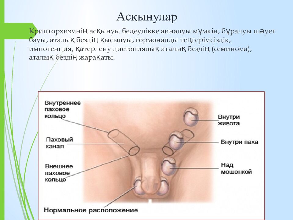 Асқынулар