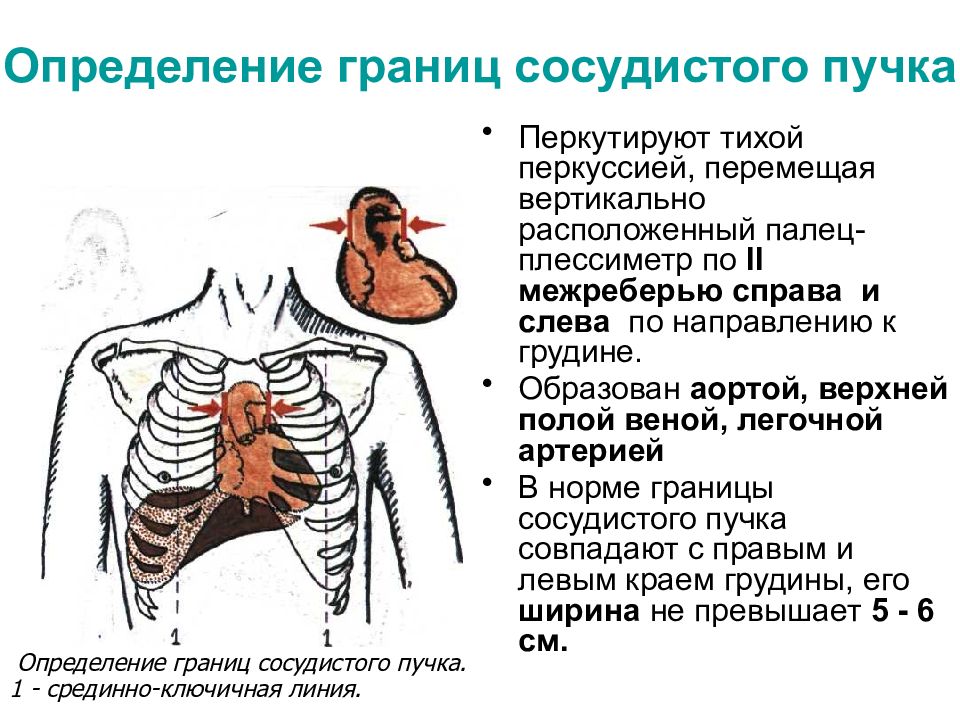 Перкуссия сердца презентация