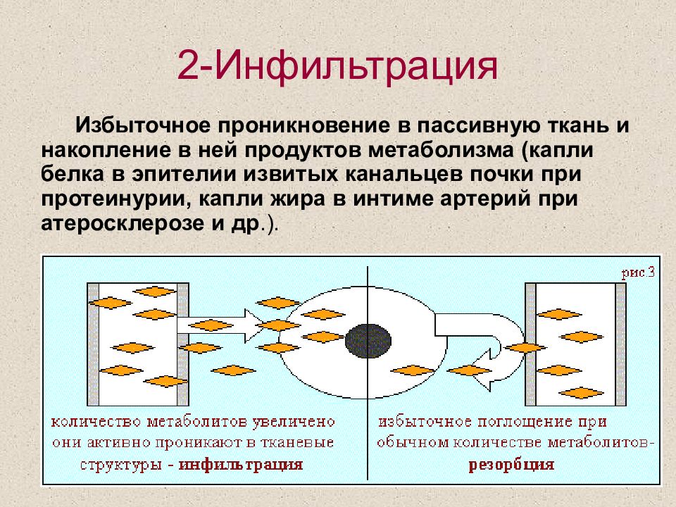 Что такое инфильтрация. Инфильтрация окружающих тканей. Инфильтрация воздуха.