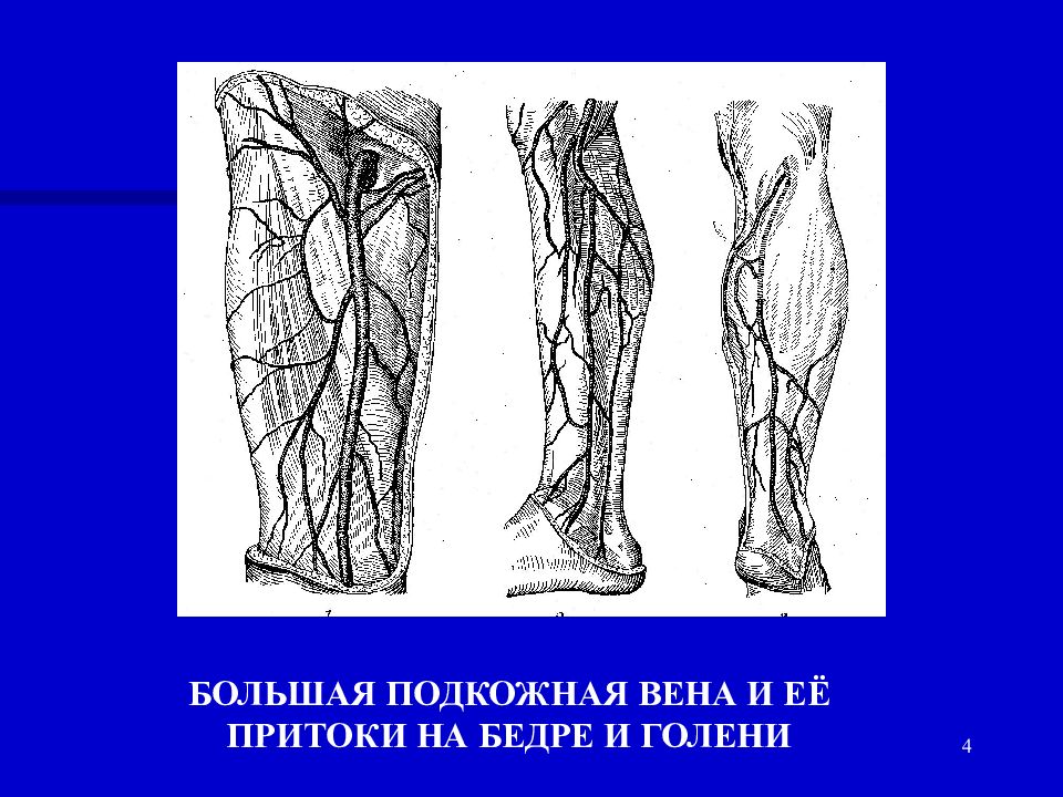 Притоки вены. Малая подкожная Вена голени. Большая подкожная Вена голени. Большая подкожная Вена бедра. Малая подкожная Вена бедра.