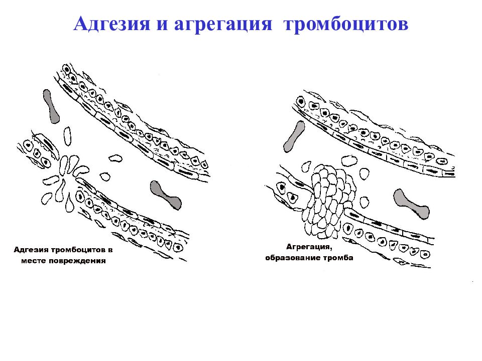 Адгезия в медицине. Адгезия тромбоцитов Электронограмма. Адгезия и агрегация тромбоцитов. Механизмы адгезии и агрегации тромбоцитов. Схема адгезии тромбоцитов.