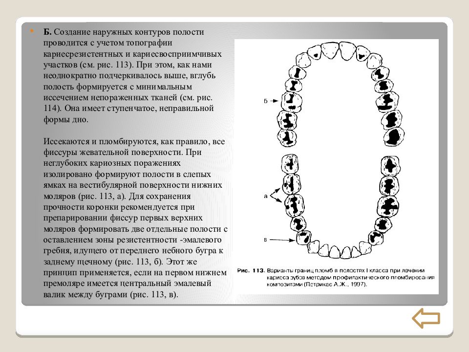 Полость проводиться. Создание «ограниченного контура полости» показано:. Ошибки при создании наружного контура 2 класса. Кариесвосприимчивые участки это. Кариесвосприимчивые и кариесрезистентные участки зуба..