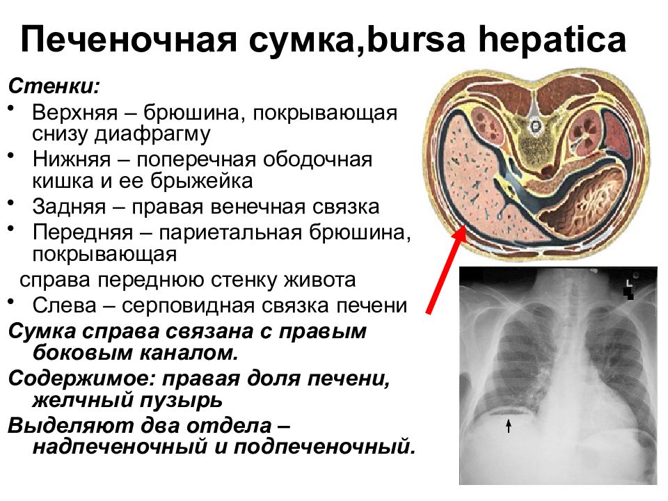 Печеночная сумка. Стенки печеночной сумки. Границы печеночной сумки. Правая печеночная сумка. Печеночная сумка брюшины.