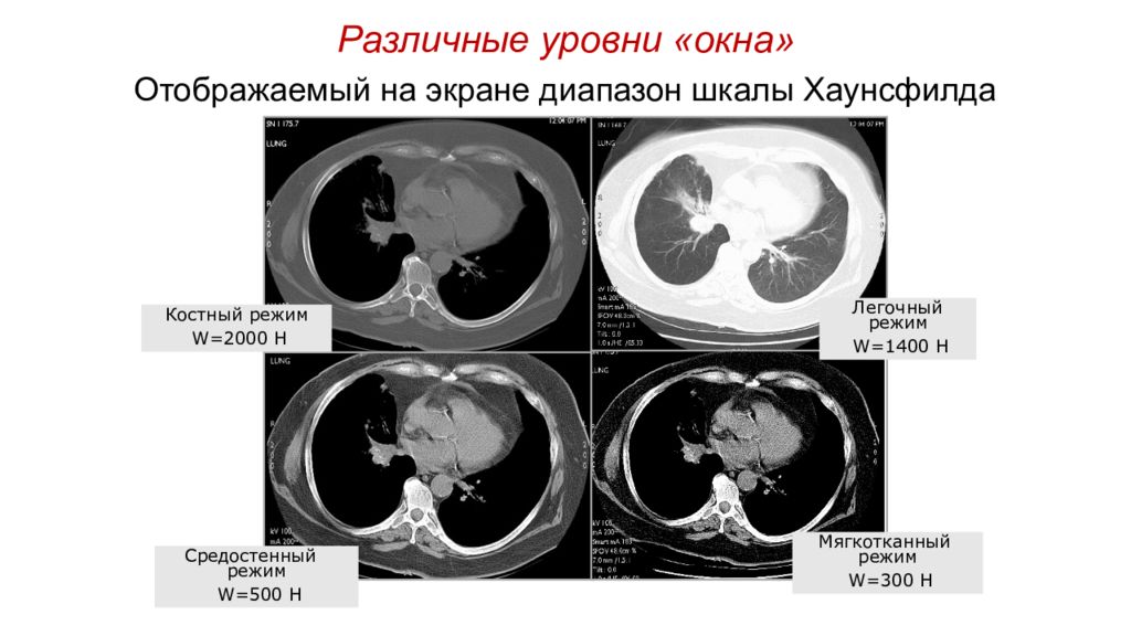 Mip изображение кт