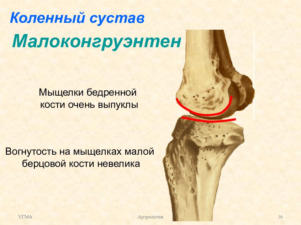 Внутренний мыщелок. Латеральный мыщелок кости. Медиальный мыщелок бедренной кости коленного сустава. Гипоплазия медиального мыщелка бедренной кости. Берцовая кость мыщелки.