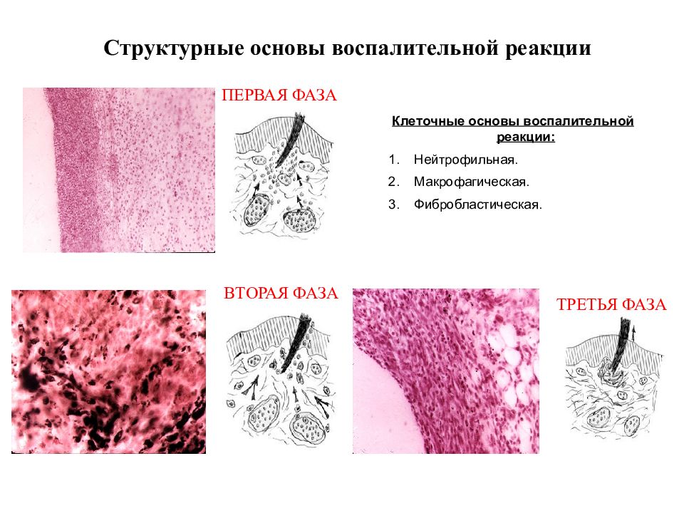 Воспалительная ткань. Рыхлая и плотная соединительная ткань. Клеточные основы воспалительной реакции. Клеточные реакции при воспалении.