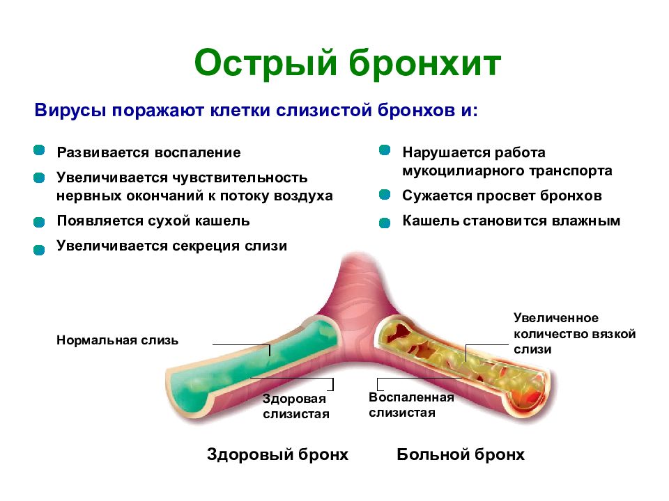 Острый бронхит презентация педиатрия