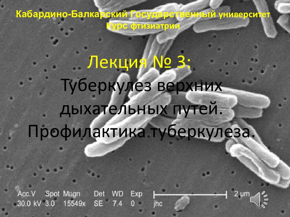 Лекция № 3: Туберкулез верхних дыхательных путей. Профилактика туберкулеза.
