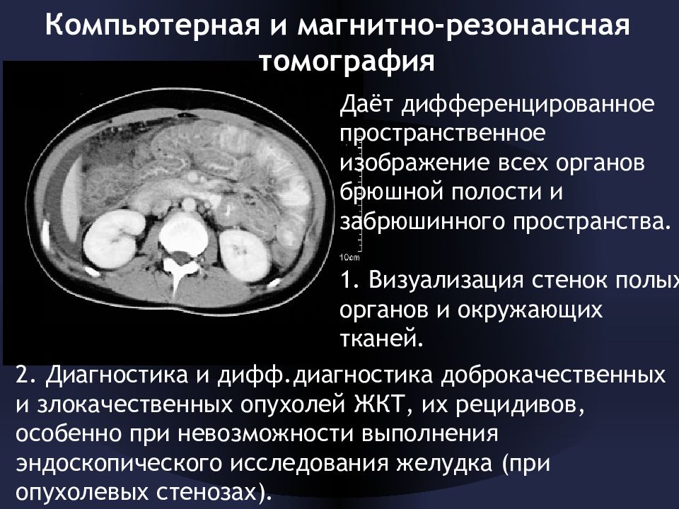 Подготовка к мрт брюшной полости. Кт и мрт брюшной полости. Кт органов брюшной полости и забрюшинного пространства. Кт или мрт брюшной полости. Мрт брюшной полости и забрюшинного пространства заключение.