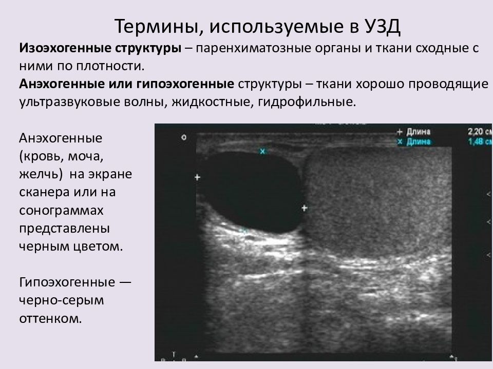 Неоднородная структура узла щитовидной железы