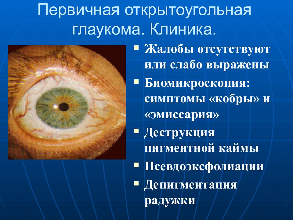 Первичная открытоугольная глаукома. Открытоугольная глаукома2 "а". Открытоугольная глаукома офтальмология. Первичная открытоугольная 2 а глаукома. .1 Первичная открытоугольная глаукома.