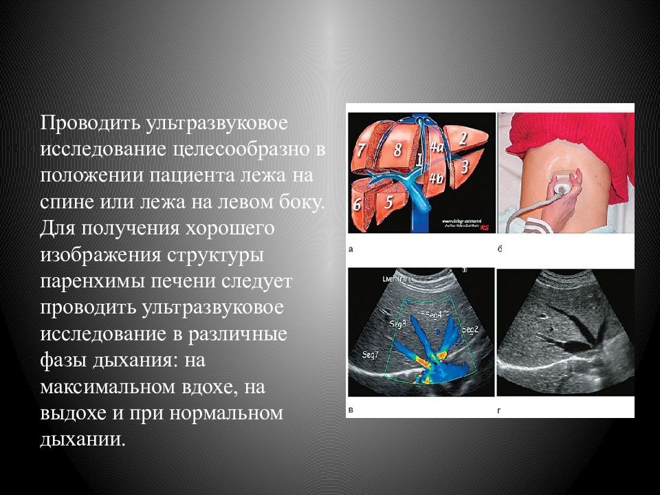 Узи брюшной полости подготовка к исследованию. Диета перед УЗИ печени. УЗИ печени положение пациента. Памятка по ультразвуковым. Схема подготовка органов перед УЗИ.