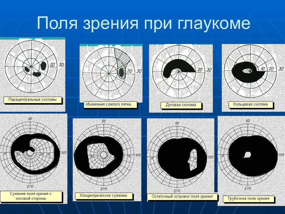 Как нарисовать поля зрения