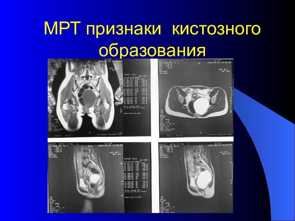 Лучевая диагностика брюшной полости презентация