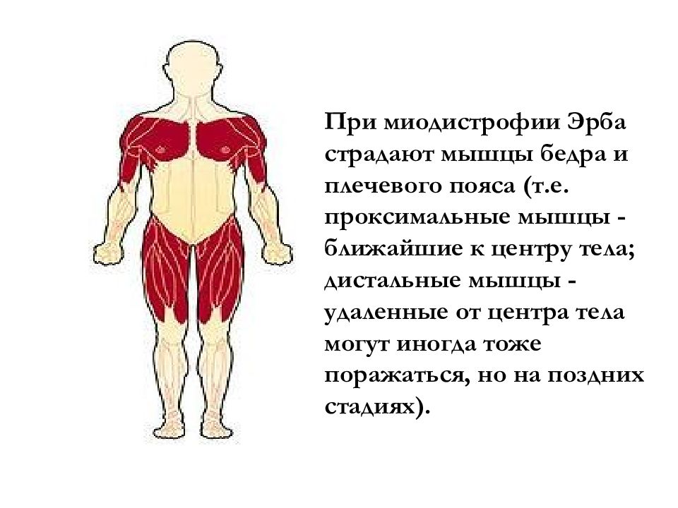 Проксимальной слабости. Проксимальные группы мышц. Проксимальные и дистальные мышцы. Проксимальная мышца бедра. Аксиальные проксимальные дистальные мышцы.