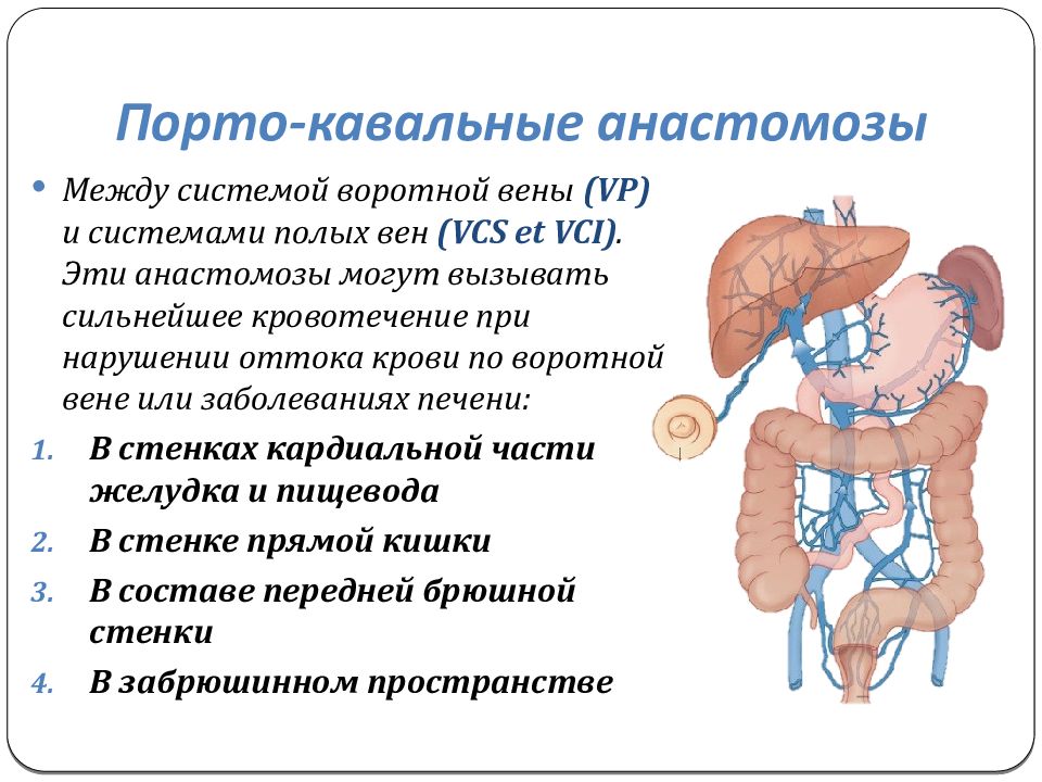 Портокавальные кава кавальные. Анастомоз желудка вены. Портокавальный анастомоз. Портокавальный анастомоз желудка. Венозный отток желудка анатомия.