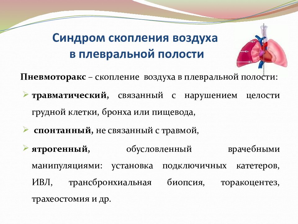 Синдром скопления жидкости. Синдром наличия воздуха в плевральной полости пропедевтика. Синдром скопления воздуха в плевральной полости. Синдром скопления воздуха в полости плевры. Синдром скопления воздуха в плевральной полости (пневмоторакс).