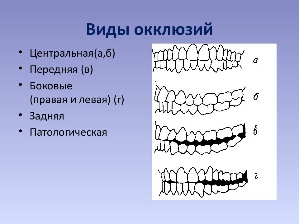 Окклюзия это