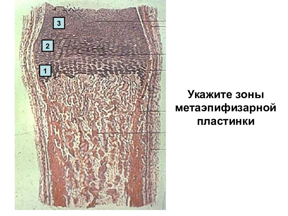Зона указана. Метаэпифизарная пластинка гистология. Зоны метаэпифизарной пластинки. Метаэпифизарная пластинка препарат. Строение метаэпифизарной пластинки.
