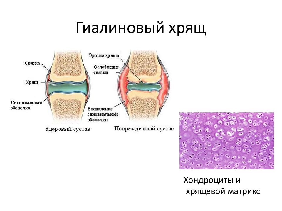 Сустав ткань. Гиалиновый хрящ бедренной кости. Строение сустава гиалиновый хрящ. Гиалиновый хрящ строение кости. Гиалиновый хрящ структурные компоненты.